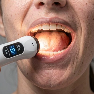 a digital scanner being used in a mouth